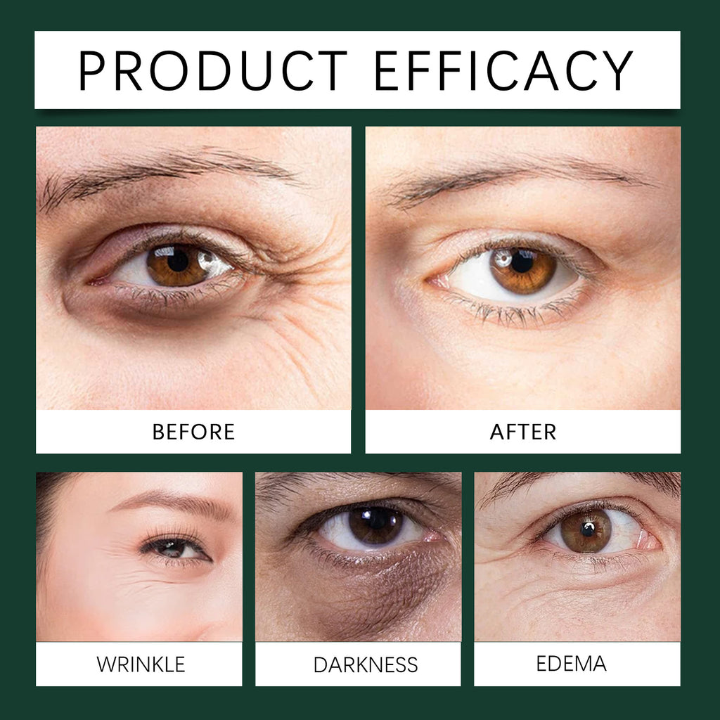 ⭐ Mint Eye Roller – Cooling Anti-Dark Circles Serum