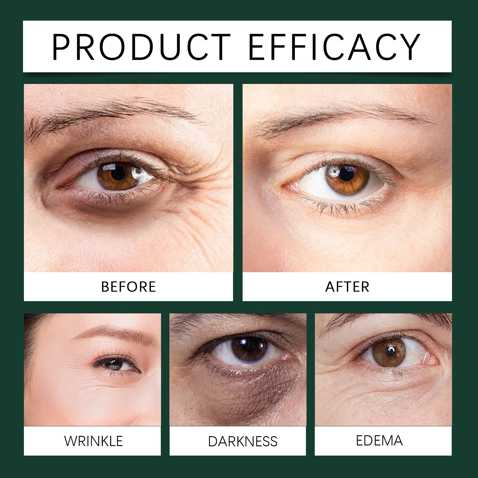 ⭐ Mint Eye Roller – Cooling Anti-Dark Circles Serum